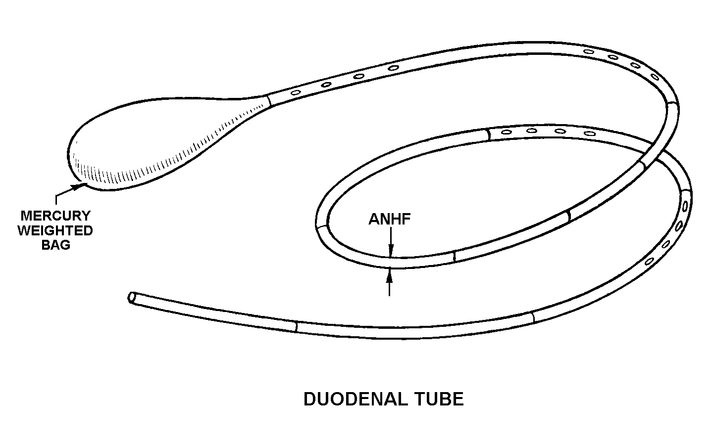 TUBE,DUODENAL,SURGI | 6515-00-065-9599, 000659599