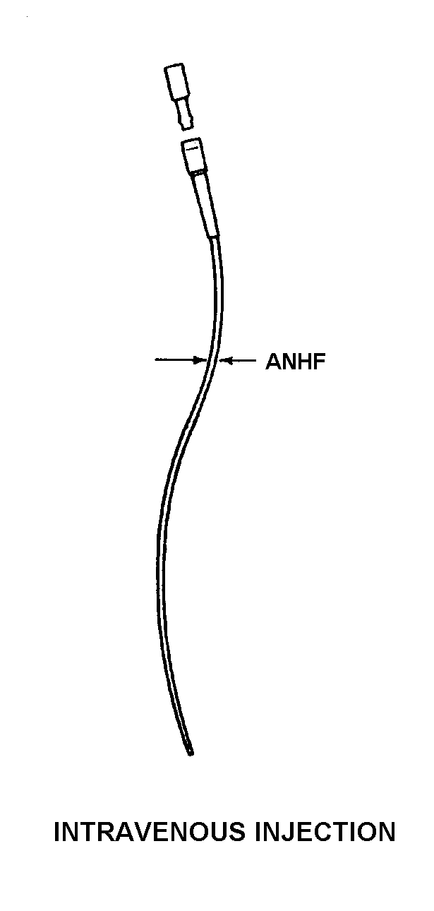 CATHETER,INTRAVENOU | 6515-00-133-0669, 001330669 CATHETER,INTRAVENOU | 6515-00-133-0669, 001330669